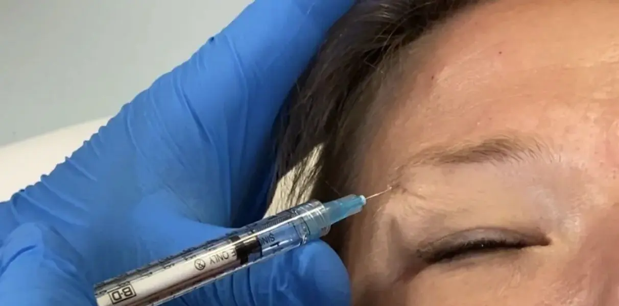 Brow Lift Injection Using Xeomin HD Aesthetics in Newtown , PA