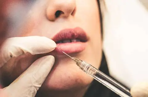 Dermal filler and Lip Filler Injections HD Aesthetics Newtown, PA